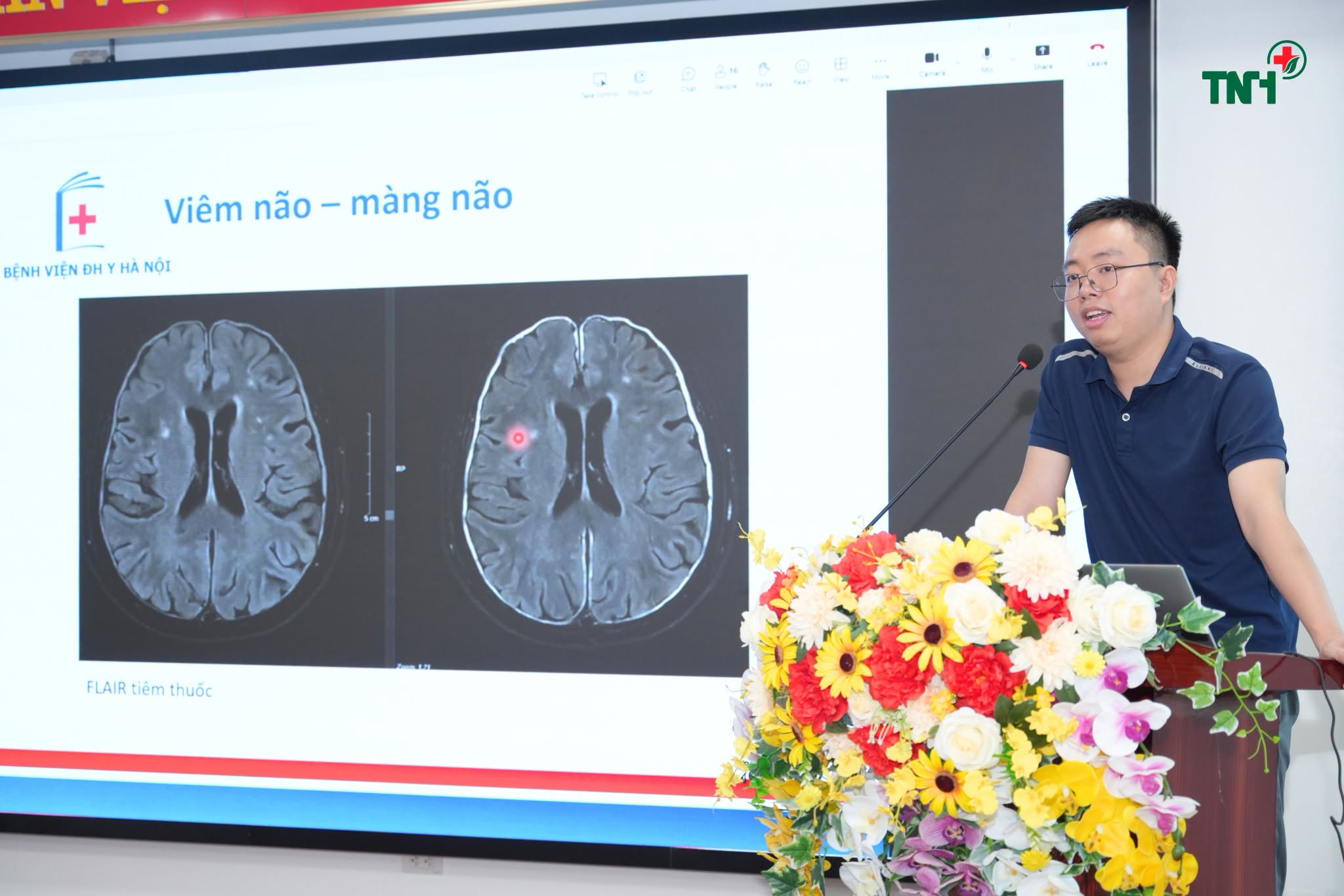 TẬP ĐOÀN BỆNH VIỆN TNH TỔ CHỨC THÀNH CÔNG HỘI THẢO CẬP NHẬT KIẾN THỨC VỀ CỘNG HƯỞNG TỪ MRI 1.5 TESLA