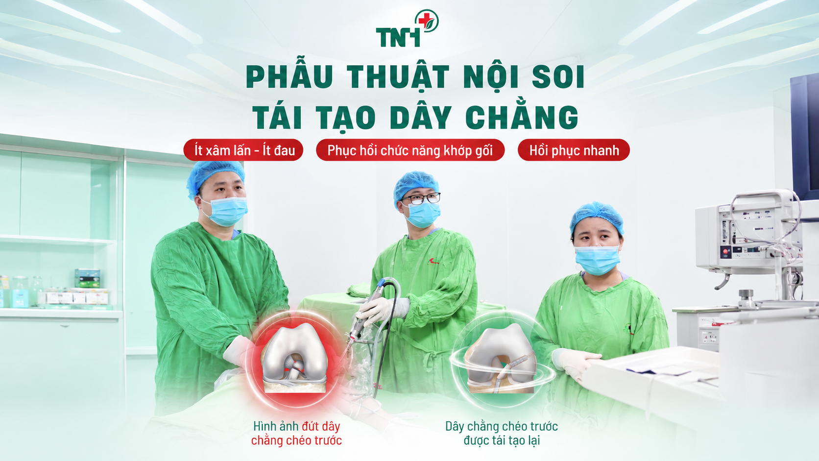 Phẫu thuật nội soi tái tạo dây chằng chéo trước – Giải pháp phục hồi vững chắc cho khớp gối tổn thương