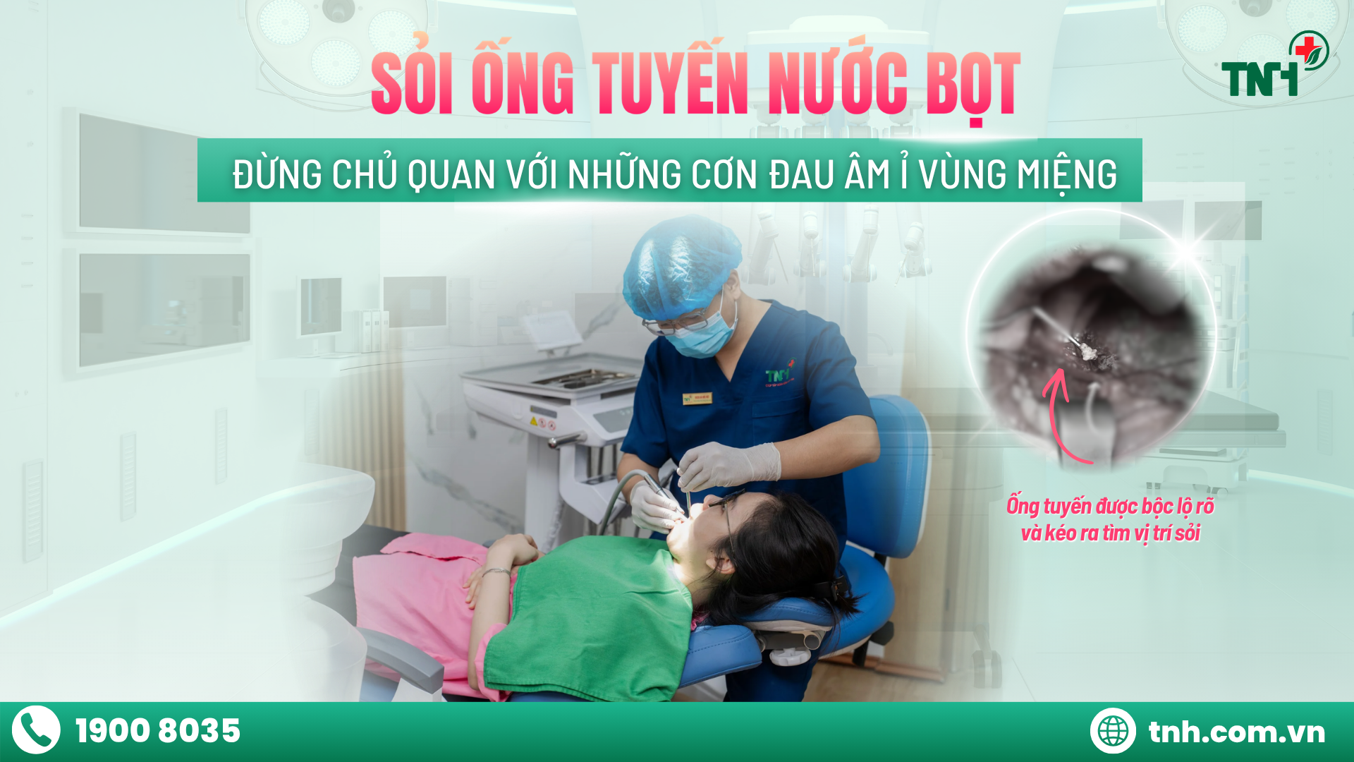 SỎI ỐNG TUYẾN NƯỚC BỌT – ĐỪNG CHỦ QUAN VỚI NHỮNG CƠN ĐAU ÂM Ỉ VÙNG MIỆNG