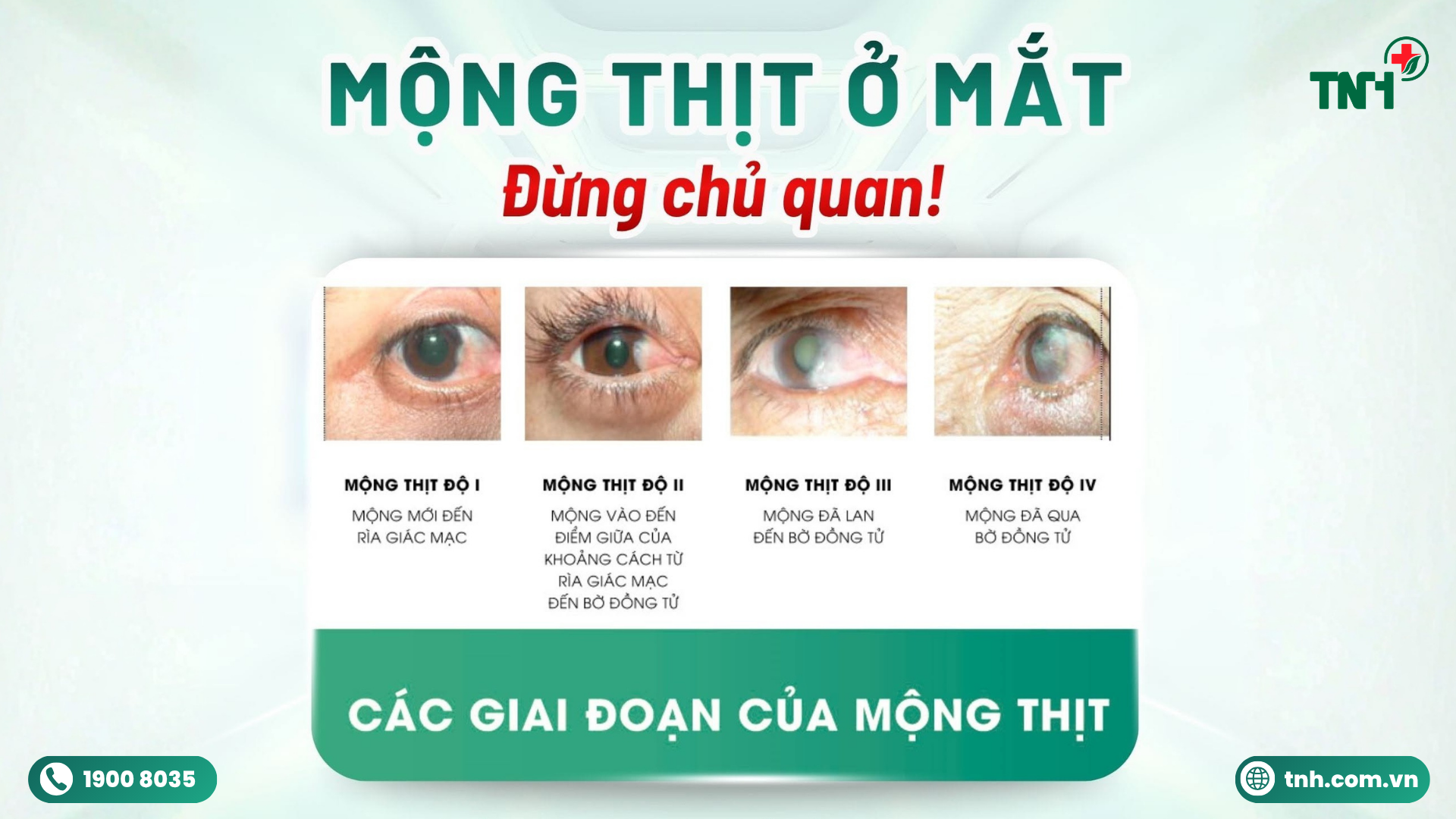 MỘNG THỊT Ở MẮT – ĐỪNG CHỦ QUAN VỚI NHỮNG DẤU HIỆU BAN ĐẦU