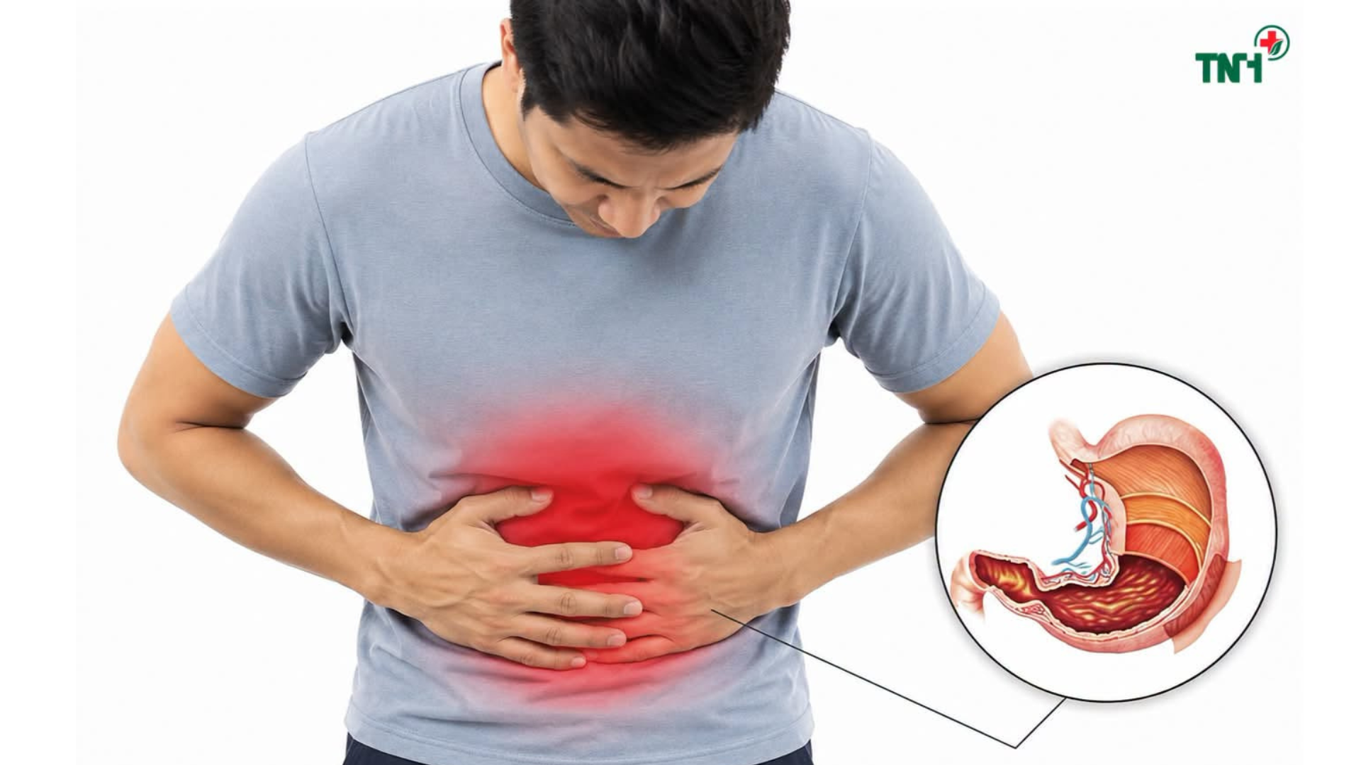 5 DẤU HIỆU CẢNH BÁO VIÊM LOÉT DẠ DÀY – ĐỪNG CHỦ QUAN VỚI NHỮNG TRIỆU CHỨNG TƯỞNG CHỪNG QUEN THUỘC