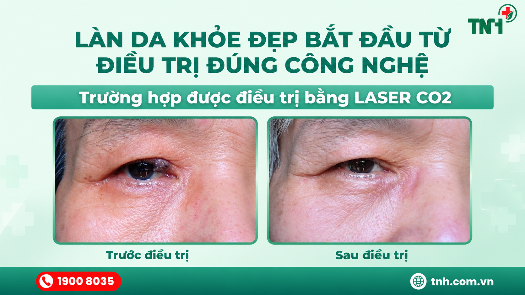 Làn da khỏe đẹp bắt đầu từ điều trị đúng công nghệ