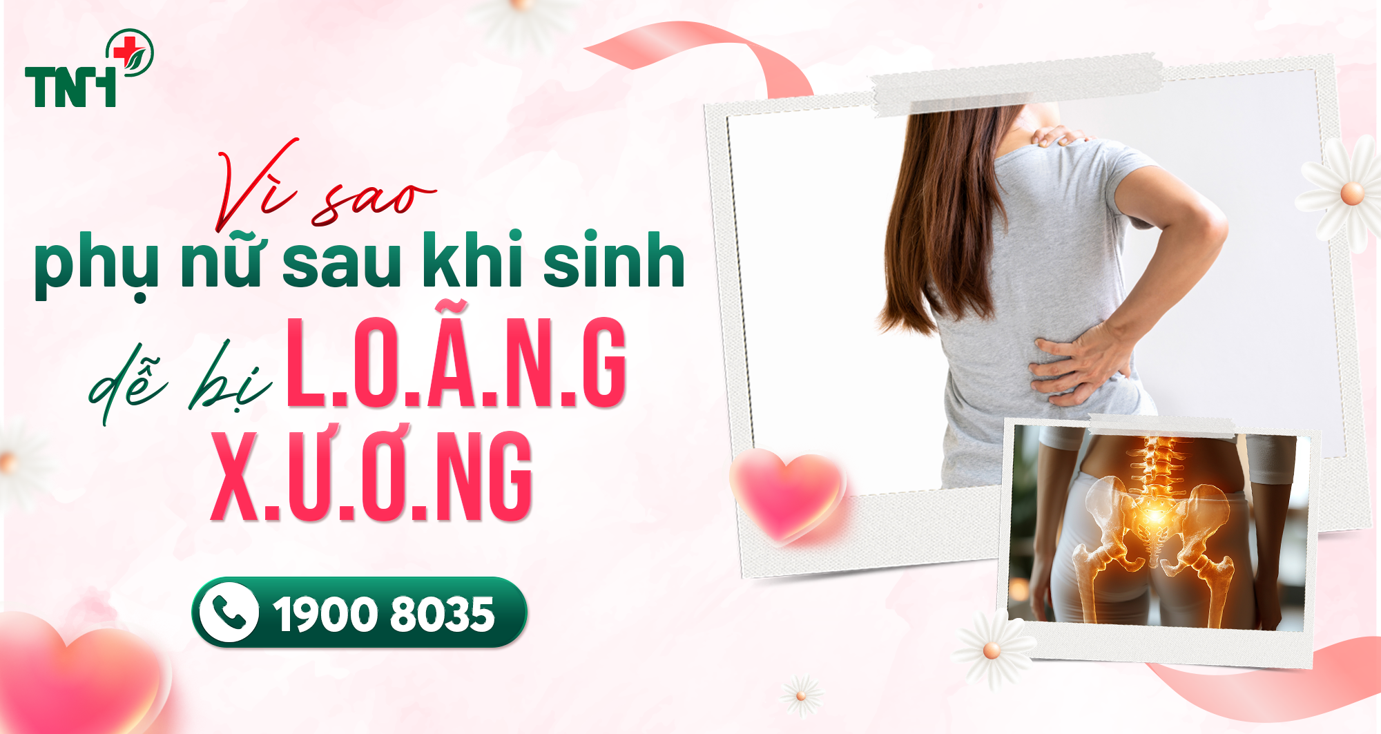 VÌ SAO PHỤ NỮ SAU SINH DỄ BỊ LOÃNG XƯƠNG?
