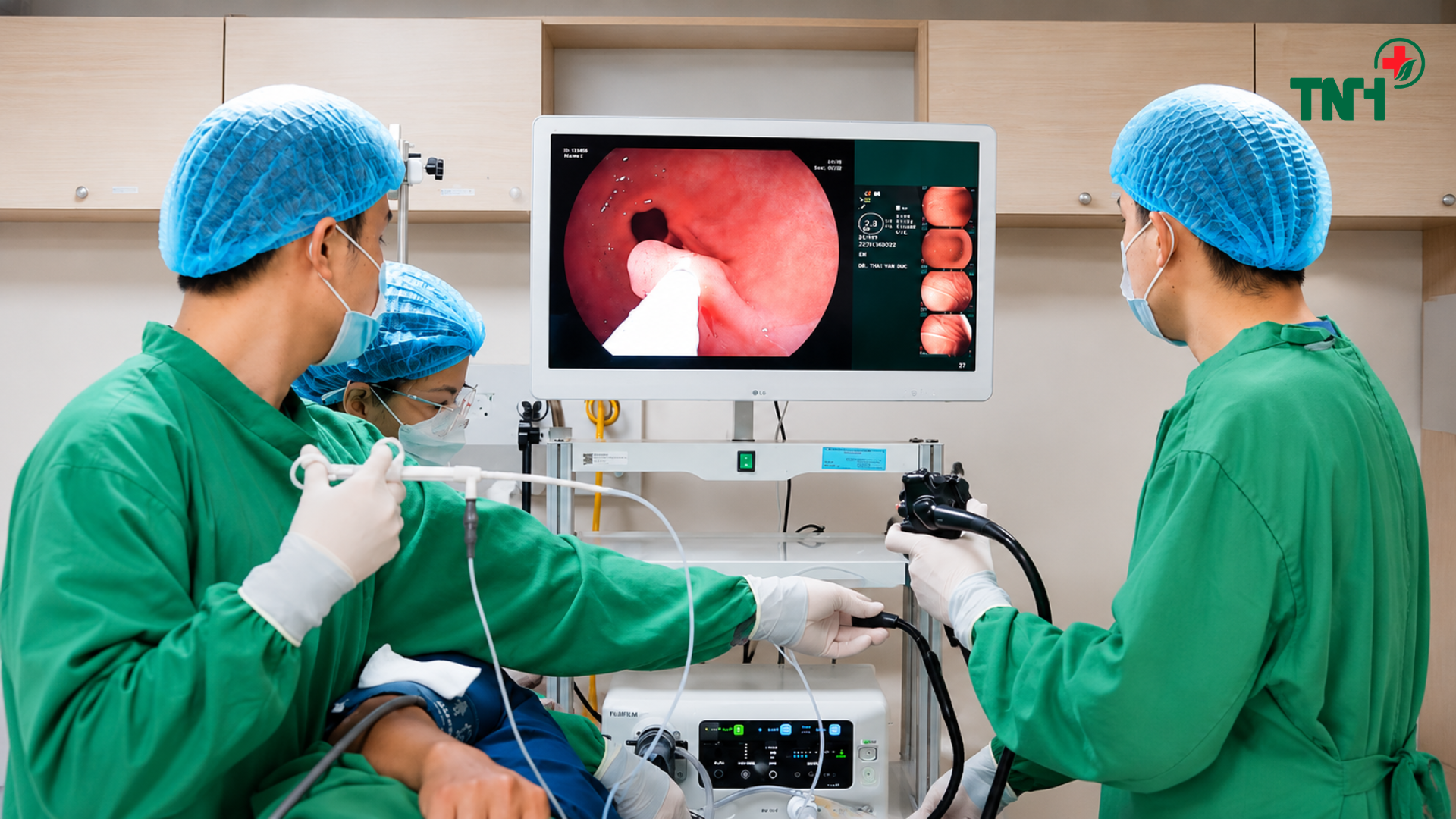 Cảnh báo ung thư đại trực tràng đang có xu hướng trẻ hóa – Đừng chủ quan với polyp đại tràng