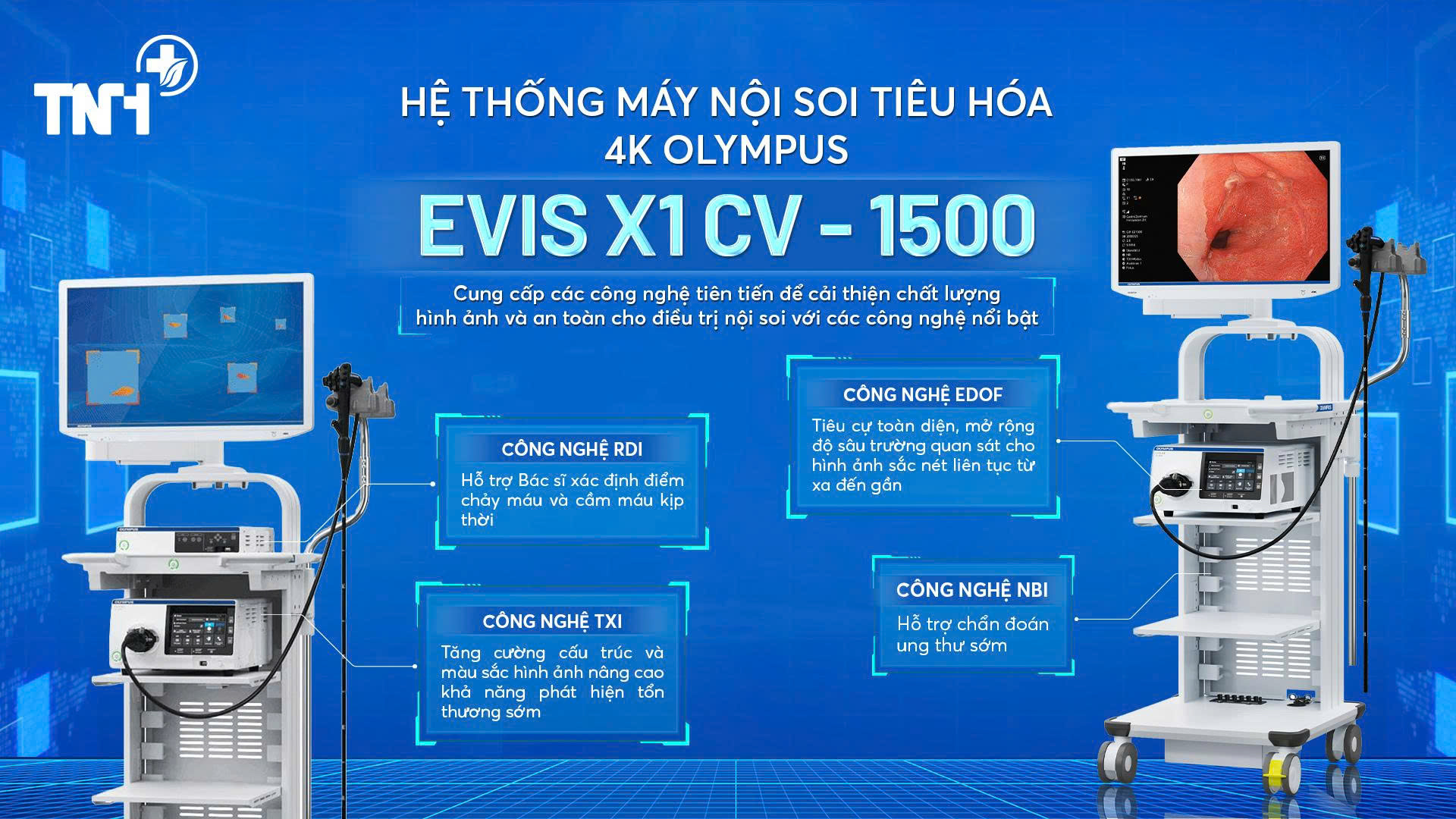 HỆ THỐNG NỘI SOI TIÊU HÓA CV 1500 (EVIS X1) TÍCH HỢP AI - NÂNG CAO HIỆU QUẢ TẦM SOÁT UNG THƯ TIÊU HÓA SỚM