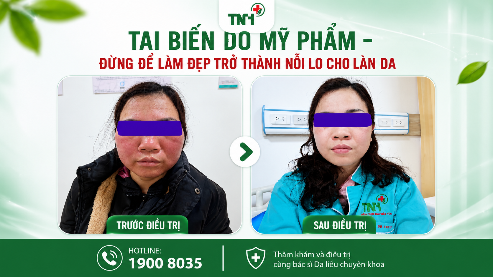 TAI BIẾN DO MỸ PHẨM – NHẬN BIẾT SỚM ĐỂ BẢO VỆ LÀN DA KHỎE MẠNH
