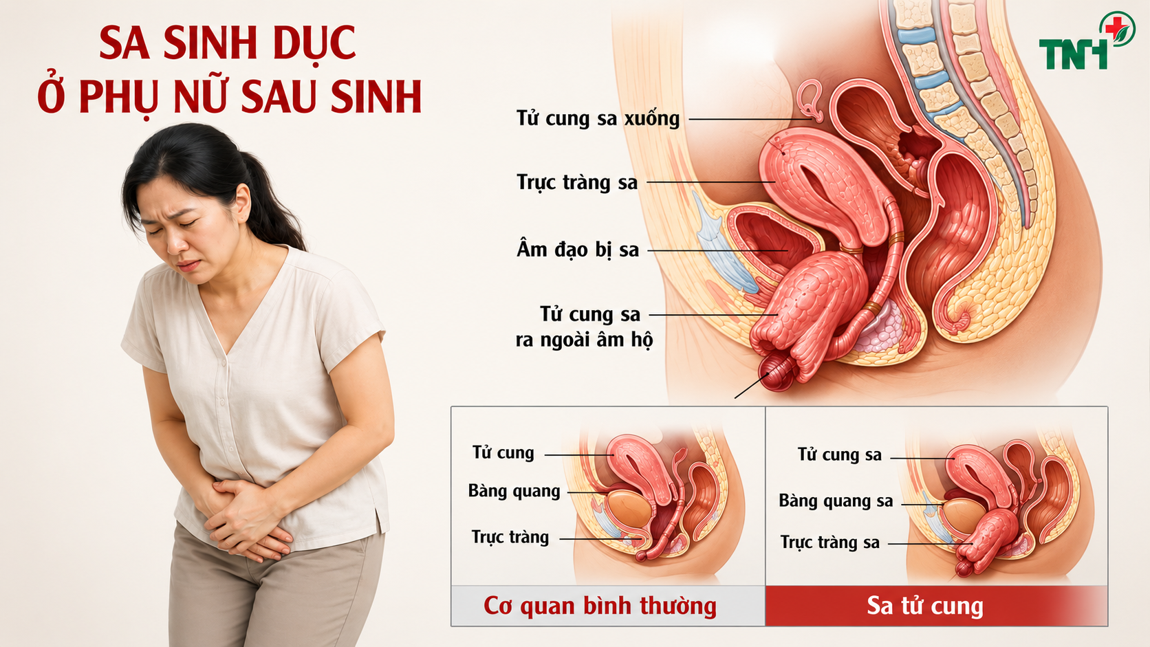 Nặng tức vùng kín, són tiểu? Đừng chủ quan với sa sinh dục