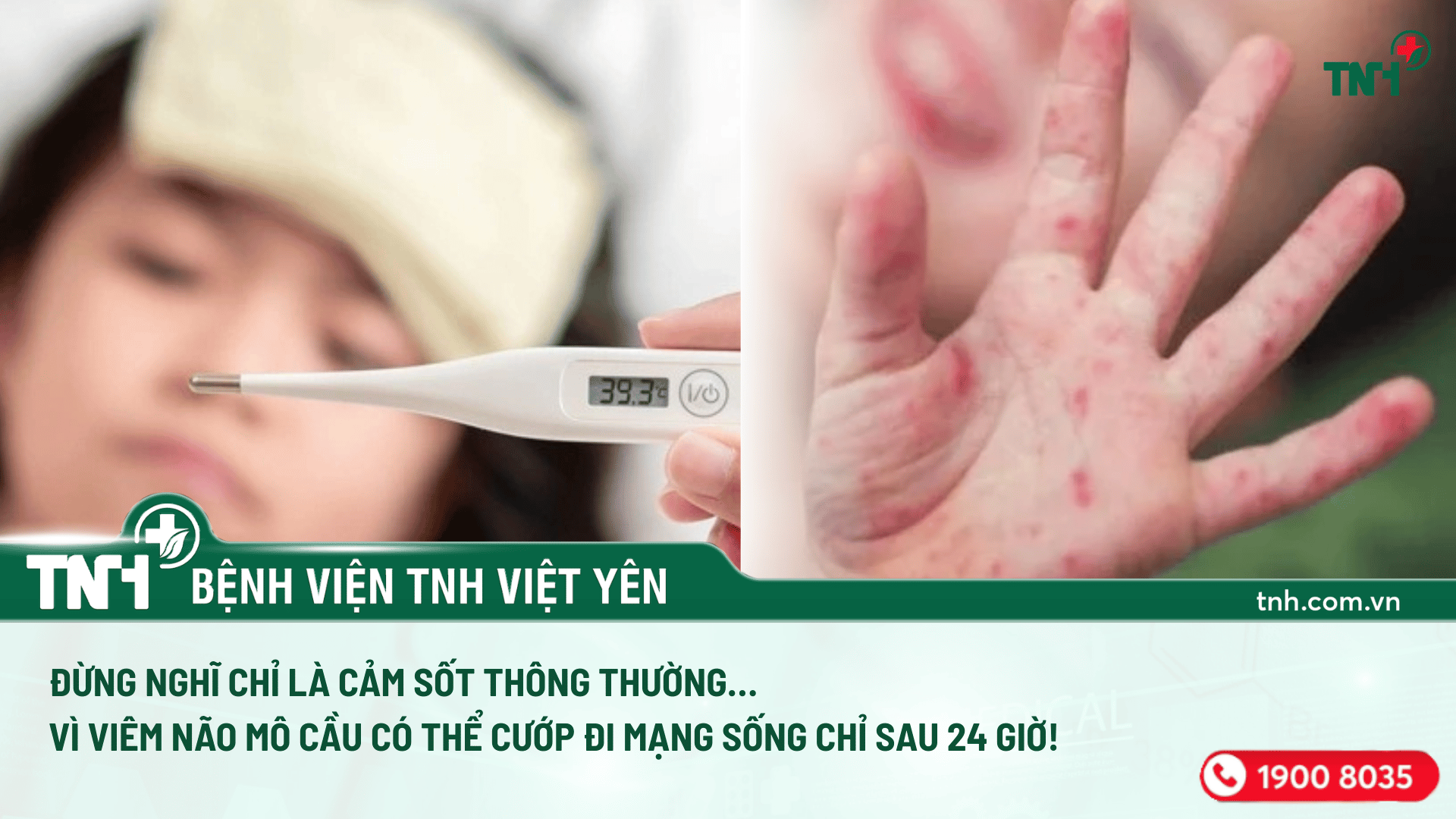 ĐỪNG NGHĨ CHỈ LÀ CẢM SỐT THÔNG THƯỜNG… VÌ VIÊM NÃO MÔ CẦU CÓ THỂ DIỄN TIẾN RẤT NHANH VÀ NGUY HIỂM