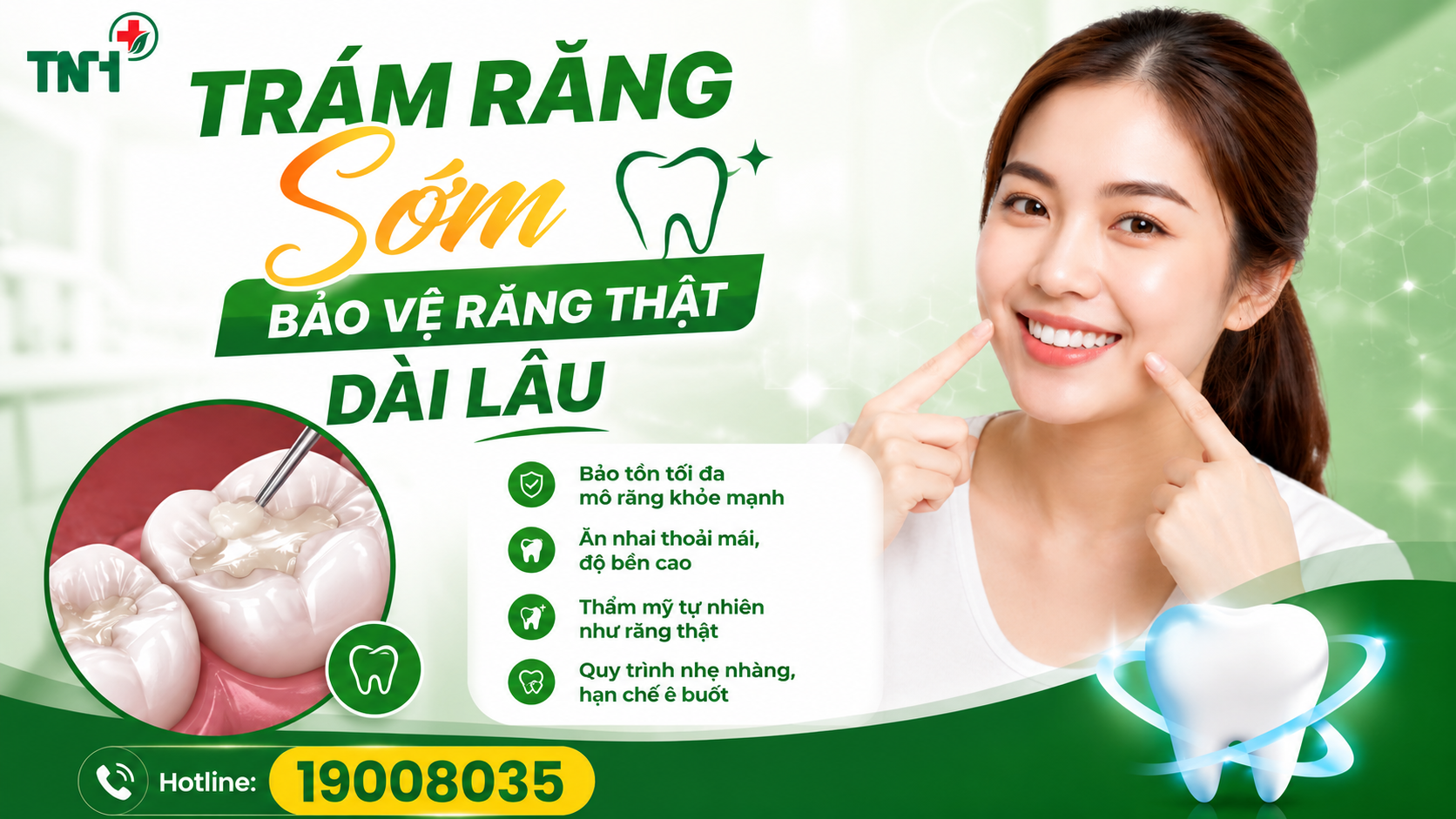 Trám răng sớm – Giải pháp bảo vệ răng thật bền vững